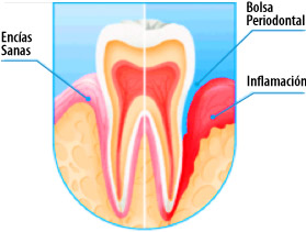 periodoncia