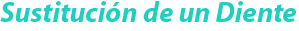 Sustitución de un diente