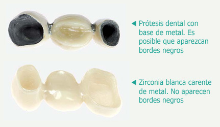 zirconio